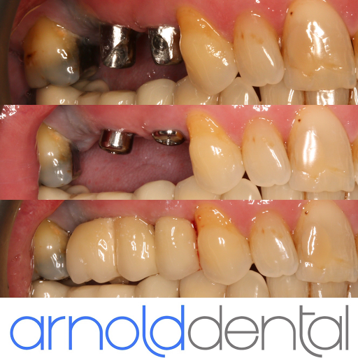 Arnold Dental & Implant Centre logo