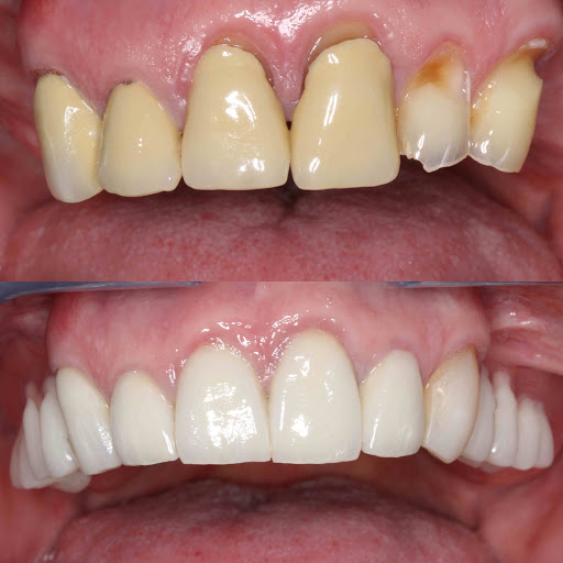 Thackeray Dental Care logo